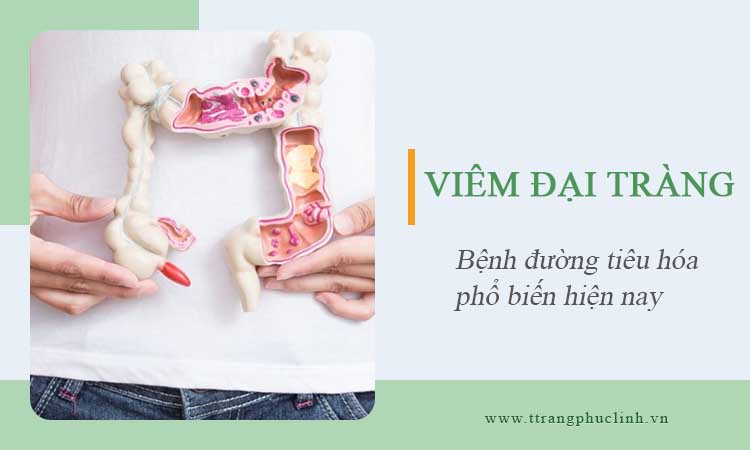 Viêm đại tràng – Nguyên nhân, triệu chứng và điều trị hiệu quả