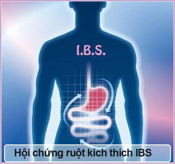 Tất cả thông tin về hội chứng ruột kích thích ibs 1